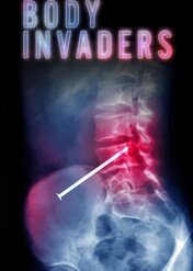 Ciało obce / Body Invaders