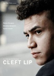 Edyp z Manchesteru / Cleft Lip